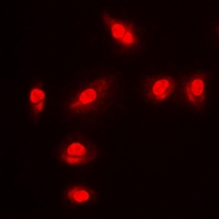 FOXO1 / FKHR Antibody - Immunofluorescent analysis of FOXO1 (pS256) staining in MCF7 cells. Formalin-fixed cells were permeabilized with 0.1% Triton X-100 in TBS for 5-10 minutes and blocked with 3% BSA-PBS for 30 minutes at room temperature. Cells were probed with the primary antibody in 3% BSA-PBS and incubated overnight at 4 deg C in a humidified chamber. Cells were washed with PBST and incubated with a DyLight 594-conjugated secondary antibody (red) in PBS at room temperature in the dark. DAPI was used to stain the cell nuclei (blue).
