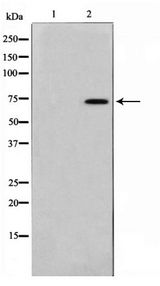 FOXO1 / FKHR Antibody - Western blot of FKHR phosphorylation expression in HeLa whole cell lysates,The lane on the left is treated with the antigen-specific peptide.