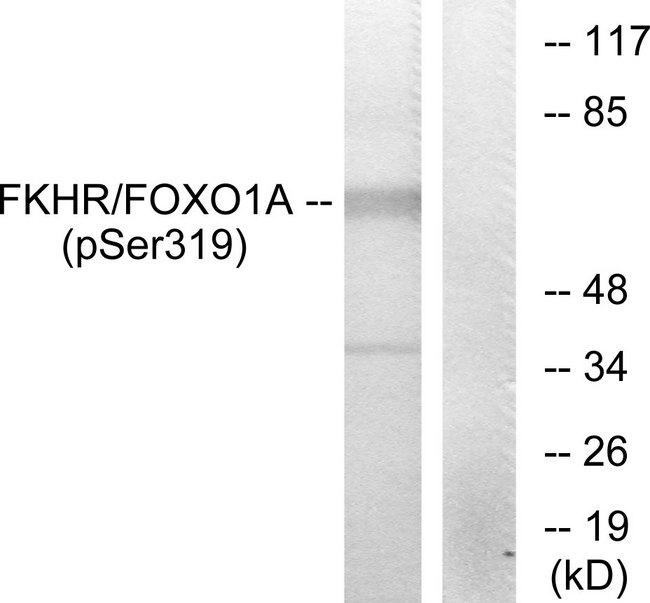 FOXO1 / FKHR Antibody - Western blot analysis of lysates from HeLa cells treated with EGF, using FKHR (Phospho-Ser319) Antibody. The lane on the right is blocked with the phospho peptide.