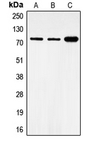 FOXO1 / FKHR Antibody - Western blot analysis of FOXO1 (pS319) expression in MCF7 (A); HeLa (B); NIH3T3 (C) whole cell lysates.