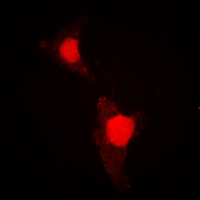 FOXO1 / FKHR Antibody - Immunofluorescent analysis of FOXO1 (pS319) staining in HeLa cells. Formalin-fixed cells were permeabilized with 0.1% Triton X-100 in TBS for 5-10 minutes and blocked with 3% BSA-PBS for 30 minutes at room temperature. Cells were probed with the primary antibody in 3% BSA-PBS and incubated overnight at 4 C in a humidified chamber. Cells were washed with PBST and incubated with a DyLight 594-conjugated secondary antibody (red) in PBS at room temperature in the dark. DAPI was used to stain the cell nuclei (blue).