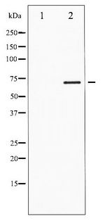 FOXO1 / FKHR Antibody - Western blot of FKHR phosphorylation expression in EGF treated HeLa whole cell lysates,The lane on the left is treated with the antigen-specific peptide.