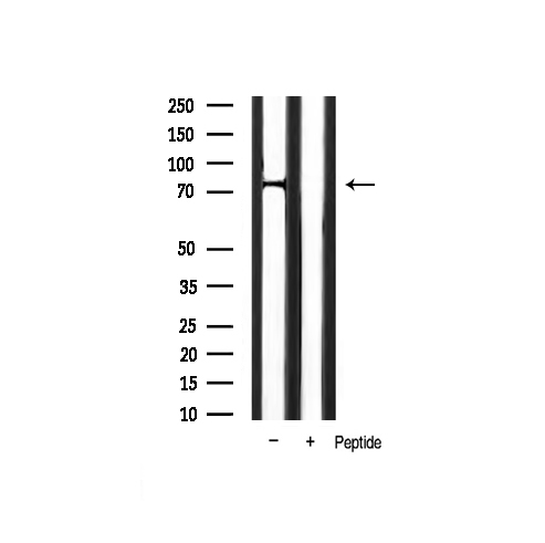 FOXO1 / FKHR Antibody - Western blot analysis of FKHR phosphorylation expression in mouse muscle tissue lysates. The lane on the right is treated with the antigen-specific peptide.