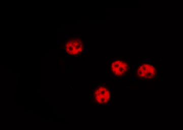 FOXO1 / FKHR Antibody - Staining HeLa cells by IF/ICC. The samples were fixed with PFA and permeabilized in 0.1% Triton X-100, then blocked in 10% serum for 45 min at 25°C. The primary antibody was diluted at 1:200 and incubated with the sample for 1 hour at 37°C. An Alexa Fluor 594 conjugated goat anti-rabbit IgG (H+L) Ab, diluted at 1/600, was used as the secondary antibody.