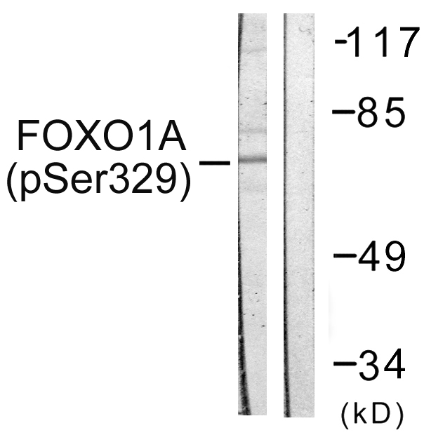 FOXO1 / FKHR Antibody - Western blot analysis of lysates from HeLa cells treated with Serum 20% 15', using FOXO1A (Phospho-Ser329) Antibody. The lane on the right is blocked with the phospho peptide.