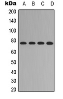 FOXO1 / FKHR Antibody - Western blot analysis of FOXO1 (pS329) expression in HEK293T (A); SHSY5Y (B); NIH3T3 (C); mouse brain (D) whole cell lysates.