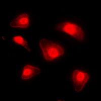 FOXO1 / FKHR Antibody - Immunofluorescent analysis of FOXO1 (pS329) staining in HepG2 cells. Formalin-fixed cells were permeabilized with 0.1% Triton X-100 in TBS for 5-10 minutes and blocked with 3% BSA-PBS for 30 minutes at room temperature. Cells were probed with the primary antibody in 3% BSA-PBS and incubated overnight at 4 deg C in a humidified chamber. Cells were washed with PBST and incubated with a DyLight 594-conjugated secondary antibody (red) in PBS at room temperature in the dark. DAPI was used to stain the cell nuclei (blue).