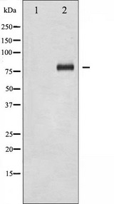 FOXO1 / FKHR Antibody - Western blot analysis of FOXO1A phosphorylation expression in Serum treated HeLa whole cells lysates. The lane on the left is treated with the antigen-specific peptide.