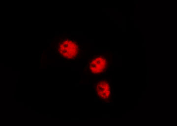 FOXO1 / FKHR Antibody - Staining HeLa cells by IF/ICC. The samples were fixed with PFA and permeabilized in 0.1% Triton X-100, then blocked in 10% serum for 45 min at 25°C. The primary antibody was diluted at 1:200 and incubated with the sample for 1 hour at 37°C. An Alexa Fluor 594 conjugated goat anti-rabbit IgG (H+L) Ab, diluted at 1/600, was used as the secondary antibody.