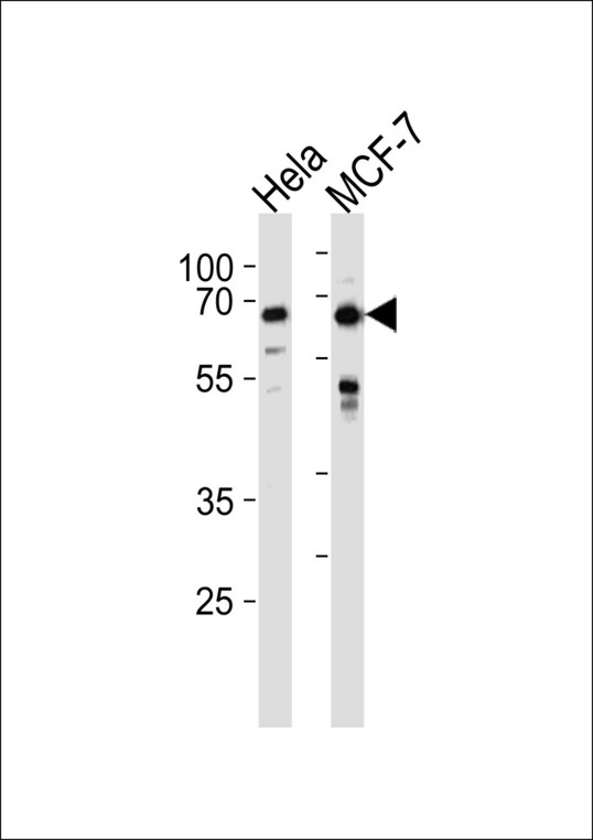 FOXO3 / FOXO3A Antibody - FOXO3 Antibody western blot of HeLa,MCF-7 cell line lysates (35 ug/lane). The FOXO3 antibody detected the FOXO3 protein (arrow).