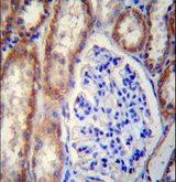 FOXO3 / FOXO3A Antibody - FOXO3 Antibody immunohistochemistry of formalin-fixed and paraffin-embedded human kidney tissue followed by peroxidase-conjugated secondary antibody and DAB staining.