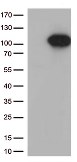 FOXO3 / FOXO3A Antibody - HEK293T cells were transfected with the pCMV6-ENTRY control. (Left lane) or pCMV6-ENTRY FOXO3. (Right lane) cDNA for 48 hrs and lysed. Equivalent amounts of cell lysates. (5 ug per lane) were separated by SDS-PAGE and immunoblotted with anti-FOXO3. (1:500)