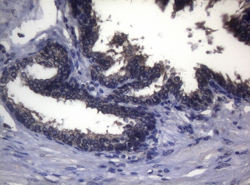 FOXO3 / FOXO3A Antibody - Immunohistochemical staining of paraffin-embedded Human prostate tissue within the normal limits using anti-FOXO3 mouse monoclonal antibody. (Heat-induced epitope retrieval by 1mM EDTA in 10mM Tris buffer. (pH8.5) at 120°C for 3 min. (1:150)