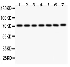 FOXO3 / FOXO3A Antibody - FOXO3A antibody Western blot. All lanes: Anti FOXO3A at 0.5 ug/ml. Lane 1: Rat Thymus Tissue Lysate at 50 ug. Lane 2: NRK Whole Cell Lysate at 40 ug. Lane 3: PC-12Whole Cell Lysate at 40 ug. Lane 4: HEPG2 Whole Cell Lysate at 40 ug. Lane 5: HELA Whole Cell Lysate at 40 ug. Lane 6: K562 Whole Cell Lysate at 40 ug. Lane 7: JURKAT Whole Cell Lysate at 40 ug. Predicted band size: 71 kD. Observed band size: 71 kD.