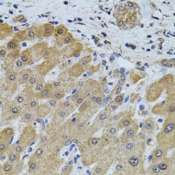 FOXO3 / FOXO3A Antibody - Immunohistochemistry of paraffin-embedded human liver injury using FOXO3 antibodyat dilution of 1:100 (40x lens).