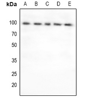FOXO3 / FOXO3A Antibody - Western blot analysis of FOXO3 expression in PC3 (A), Hela (B), U87MG (C), A549 (D), mouse lung (E) whole cell lysates.