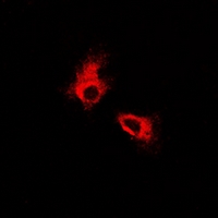 FOXO3 / FOXO3A Antibody - Immunofluorescent analysis of FOXO3 staining in MCF7 cells. Formalin-fixed cells were permeabilized with 0.1% Triton X-100 in TBS for 5-10 minutes and blocked with 3% BSA-PBS for 30 minutes at room temperature. Cells were probed with the primary antibody in 3% BSA-PBS and incubated overnight at 4 °C in a hidified chamber. Cells were washed with PBST and incubated with Alexa Fluor 647-conjugated secondary antibody (red) in PBS at room temperature in the dark.