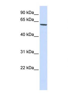 FOXO4 / AFX1 Antibody - FOXO4 antibody Western blot of 293T Cell lysate. Antibody concentration 1 ug/ml. This image was taken for the unconjugated form of this product. Other forms have not been tested.