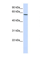 FOXO4 / AFX1 Antibody - FOXO4 antibody Western blot of 293T Cell lysate. Antibody concentration 1 ug/ml. This image was taken for the unconjugated form of this product. Other forms have not been tested.