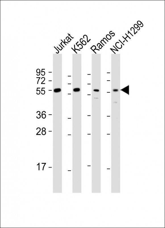FOXO4 / AFX1 Antibody - All lanes: Anti-FOXO4 Antibody (Center) at 1:1000-1:2000 dilution. Lane 1: Jurkat whole cell lysates. Lane 2: K562 whole cell lysates. Lane 3: Ramos whole cell lysates. Lane 4: NCI-H1299 whole cell lysates Lysates/proteins at 20 ug per lane. Secondary Goat Anti-Rabbit IgG, (H+L), Peroxidase conjugated at 1:10000 dilution. Predicted band size: 54 kDa. Blocking/Dilution buffer: 5% NFDM/TBST.