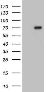 FOXO4 / AFX1 Antibody - HEK293T cells were transfected with the pCMV6-ENTRY control. (Left lane) or pCMV6-ENTRY FOXO4. (Right lane) cDNA for 48 hrs and lysed. Equivalent amounts of cell lysates. (5 ug per lane) were separated by SDS-PAGE and immunoblotted with anti-FOXO4. (1:2000)