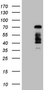 FOXO4 / AFX1 Antibody - HEK293T cells were transfected with the pCMV6-ENTRY control. (Left lane) or pCMV6-ENTRY FOXO4. (Right lane) cDNA for 48 hrs and lysed. Equivalent amounts of cell lysates. (5 ug per lane) were separated by SDS-PAGE and immunoblotted with anti-FOXO4. (1:2000)