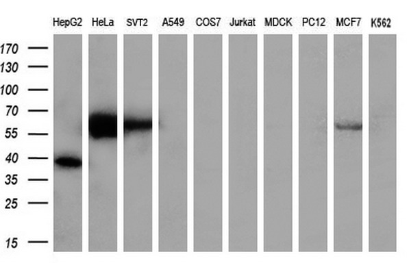 FOXO4 / AFX1 Antibody - Western blot analysis of extracts. (10ug) from 10 different cell lines by using anti-FOXO4 monoclonal antibody. (1:200)