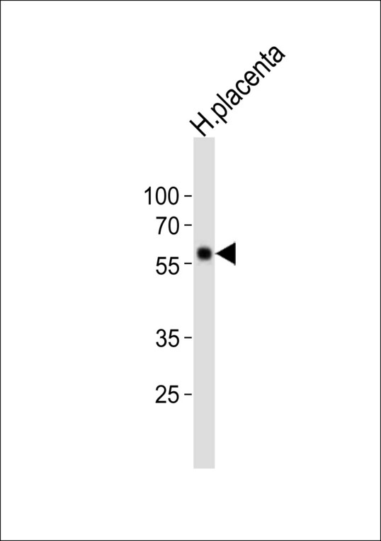 FOXO4 / AFX1 Antibody - Western blot of lysate from human placenta tissue lysate, using FOXO4 antibody diluted at 1:1000. A goat anti-rabbit IgG H&L (HRP) at 1:10000 dilution was used as the secondary antibody. Lysate at 20 ug.