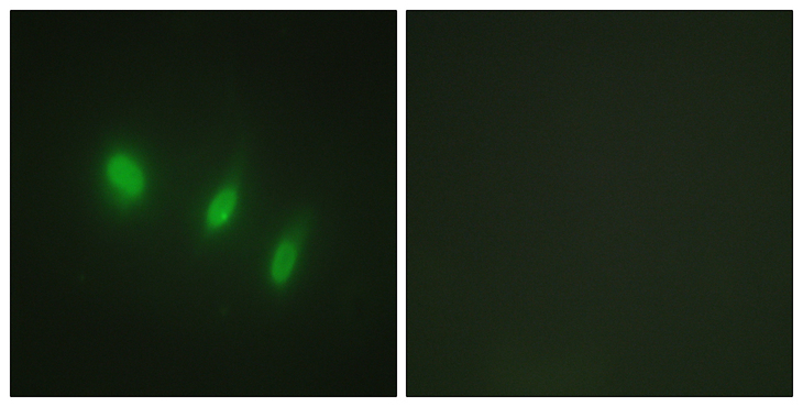 FOXO4 / AFX1 Antibody - Immunofluorescence analysis of HeLa cells, using FOXO4 Antibody. The picture on the right is blocked with the synthesized peptide.