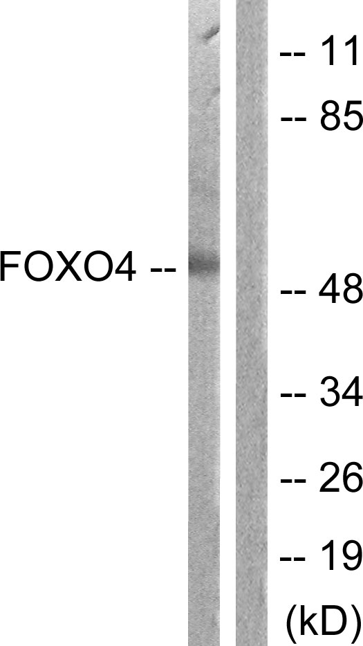 FOXO4 / AFX1 Antibody - Western blot analysis of lysates from K562 cells, using FOXO4 Antibody. The lane on the right is blocked with the synthesized peptide.