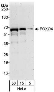 FOXO4 / AFX1 Antibody - Detection of Human FOXO4 by Western Blot. Samples: Whole cell lysate (5, 15, and 50 ug) from HeLa cells. Antibodies: Affinity purified rabbit anti-FOXO4 antibody used for WB at 0.1 ug/ml. Detection: Chemiluminescence with an exposure time of 3 minutes.