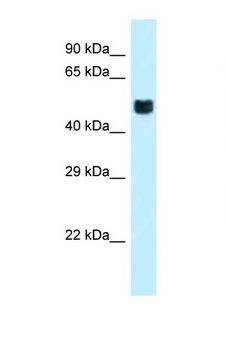 FOXO4 / AFX1 Antibody - FOXO4 antibody Western blot of Mouse Pancreas lysate. Antibody concentration 1 ug/ml.  This image was taken for the unconjugated form of this product. Other forms have not been tested.