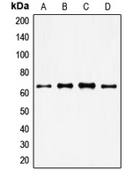 FOXO4 / AFX1 Antibody - Western blot analysis of FOXO4 expression in HeLa (A); MM142 (B); HuT78 (C); NIH3T3 (D) whole cell lysates.