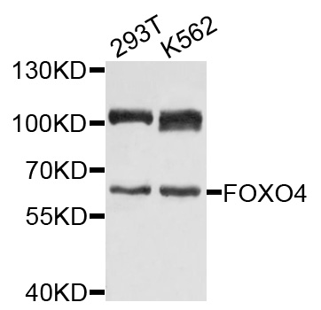 FOXO4 / AFX1 Antibody - Western blot analysis of extracts of various cells.