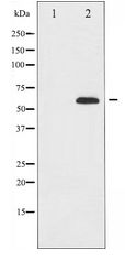 FOXO4 / AFX1 Antibody - Western blot of FOXO4 expression in K562 whole cell lysates,The lane on the left is treated with the antigen-specific peptide.