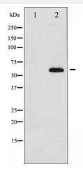 FOXO4 / AFX1 Antibody - Western blot of AFX expression in serum treated 293 whole cell lysates,The lane on the left is treated with the antigen-specific peptide.