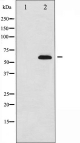 FOXO4 / AFX1 Antibody - Western blot analysis of AFX expression in serum treated 293 whole cells lysates. The lane on the left is treated with the antigen-specific peptide.