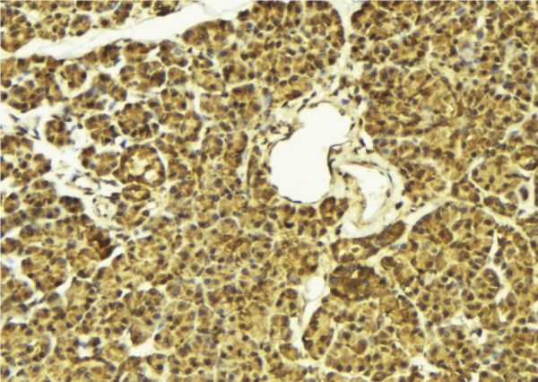 FOXO4 / AFX1 Antibody - 1:100 staining mouse pancreas tissue by IHC-P. The sample was formaldehyde fixed and a heat mediated antigen retrieval step in citrate buffer was performed. The sample was then blocked and incubated with the antibody for 1.5 hours at 22°C. An HRP conjugated goat anti-rabbit antibody was used as the secondary.