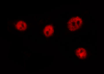 FOXO4 / AFX1 Antibody - Staining HuvEc cells by IF/ICC. The samples were fixed with PFA and permeabilized in 0.1% Triton X-100, then blocked in 10% serum for 45 min at 25°C. The primary antibody was diluted at 1:200 and incubated with the sample for 1 hour at 37°C. An Alexa Fluor 594 conjugated goat anti-rabbit IgG (H+L) Ab, diluted at 1/600, was used as the secondary antibody.