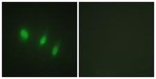 FOXO4 / AFX1 Antibody - Peptide - + Immunofluorescence analysis of HeLa cells, using FOXO4 (Ab-451) antibody.