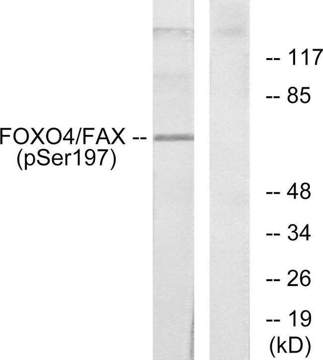 FOXO4 / AFX1 Antibody - Western blot analysis of lysates from 293 cells treated with serum, using AFX (Phospho-Ser197) Antibody. The lane on the right is blocked with the phospho peptide.