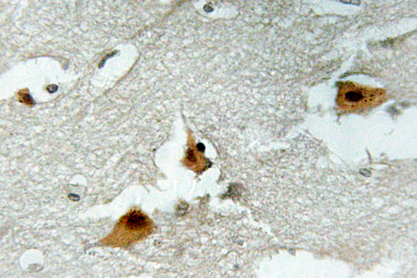 FOXO4 / AFX1 Antibody - IHC of p-AFX1 (S197) pAb in paraffin-embedded human brain tissue.