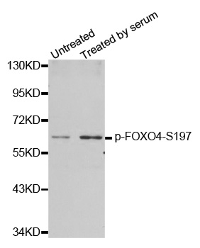 FOXO4 / AFX1 Antibody - Western blot analysis of extracts from 293 cells.