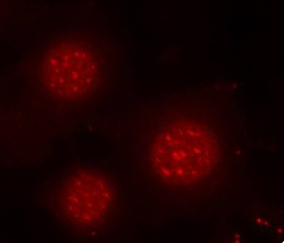 FOXO4 / AFX1 Antibody - Immunofluorescence staining of methanol-fixed MCF7 cells.