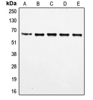 FOXO4 / AFX1 Antibody - Western blot analysis of FOXO4 (pS197) expression in HeLa (A); MM142 (B); HuT78 (C); HEK293T (D); NIH3T3 (E) whole cell lysates.