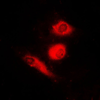 FOXO4 / AFX1 Antibody - Immunofluorescent analysis of FOXO4 (pS197) staining in HeLa cells. Formalin-fixed cells were permeabilized with 0.1% Triton X-100 in TBS for 5-10 minutes and blocked with 3% BSA-PBS for 30 minutes at room temperature. Cells were probed with the primary antibody in 3% BSA-PBS and incubated overnight at 4 C in a humidified chamber. Cells were washed with PBST and incubated with a DyLight 594-conjugated secondary antibody (red) in PBS at room temperature in the dark. DAPI was used to stain the cell nuclei (blue).