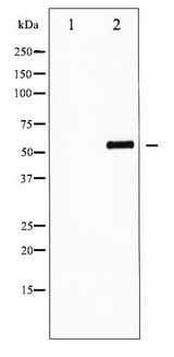 FOXO4 / AFX1 Antibody - Western blot of AFX phosphorylation expression in serum treated 293 whole cell lysates,The lane on the left is treated with the antigen-specific peptide.