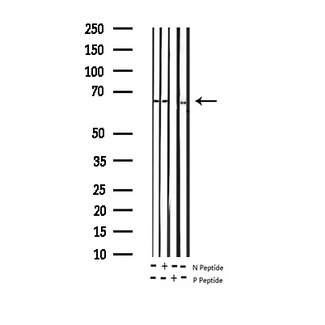 FOXO4 / AFX1 Antibody - Western blot analysis of Phospho-AFX (Ser197) expression in various lysates