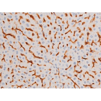 FOXO4 / AFX1 Antibody - 1:200 staining mouse liver tissue by IHC-P. The tissue was formaldehyde fixed and a heat mediated antigen retrieval step in citrate buffer was performed. The tissue was then blocked and incubated with the antibody for 1.5 hours at 22°C. An HRP conjugated goat anti-rabbit antibody was used as the secondary.