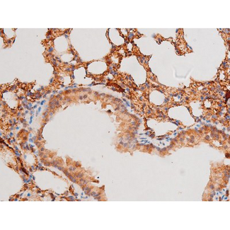 FOXO4 / AFX1 Antibody - 1:200 staining mouse lung tissue by IHC-P. The tissue was formaldehyde fixed and a heat mediated antigen retrieval step in citrate buffer was performed. The tissue was then blocked and incubated with the antibody for 1.5 hours at 22°C. An HRP conjugated goat anti-rabbit antibody was used as the secondary.